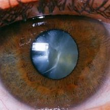 Slider image (2) Dr. Armando Capote. AMECAE